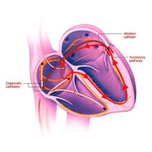 arrhythmia-diagnosis-management